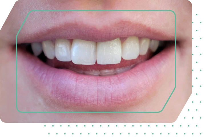 Healthy cosmetic dental smile
