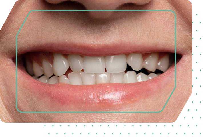 Bright, straight white smile